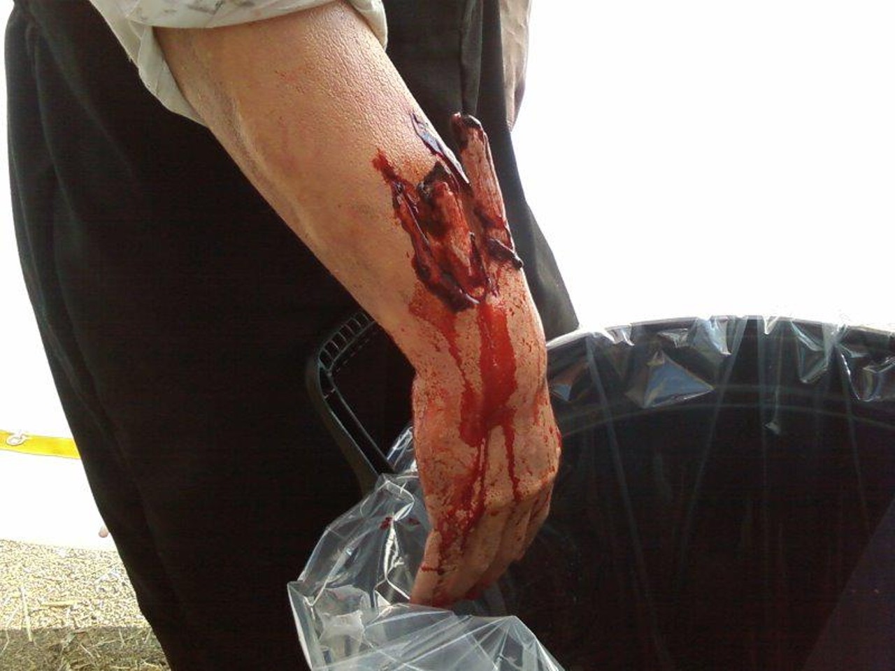 A compound fracture done for one of the Children of the Corn films.