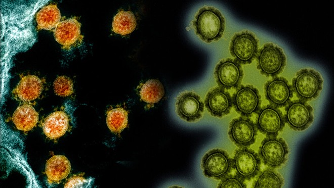 SARS-CoV-2, the virus that causes COVID-19 (shown in a colorized electron micrograph, left, in orange) may soon face off against influenza (H1N1 influenza virus particles in green, right) as seen in this composite image. Even scientists don't yet know how the encounter will end. - NIAID