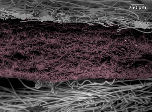 N95: In an N95 mask (seen in false color cross section), a thin outer layer (top) and a thick inner layer (bottom) sandwich a filtration layer (purple), which traps the smallest particles. The multilayered assemblage made of plastic is melted and blown into a weblike fabric, which makes N95s filter particles better than cloth masks, even cotton ones. - E.P. Vicenzi/Smithsonian Museum Conservation Institute and NIST
