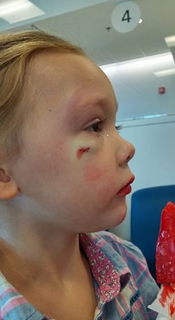 Ohio Hospital Employee Tells Little Girl That Boy Who Sliced Her Face Open Probably Just 'Likes' Her