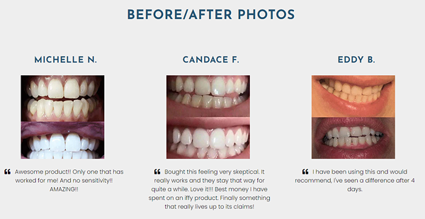 The Facts About Cheap Used Kit Snow Teeth Whitening Revealed